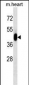 MAPK3 Antibody